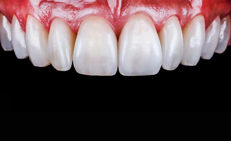 After -Bridge Dental