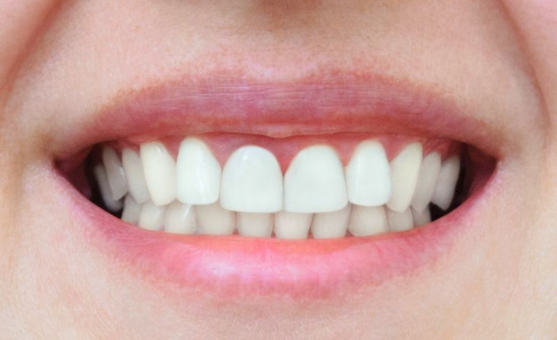 After -Bridge Dental