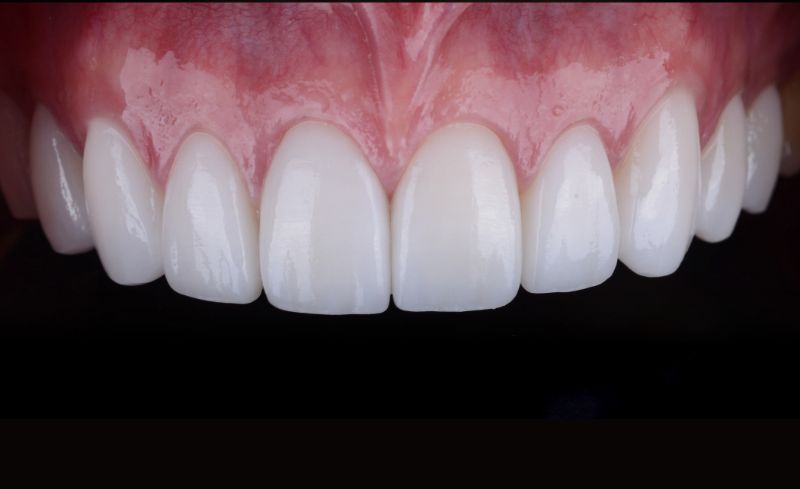 After -Bridge Dental